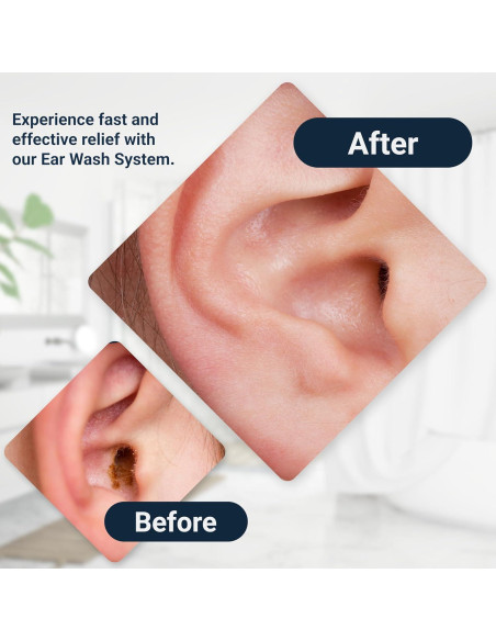 Sistema de lavado de oídos Wax-Rx Doctor Easy 450 ml Sistema de lavado de oídos Wax-Rx Doctor Easy 450 ml