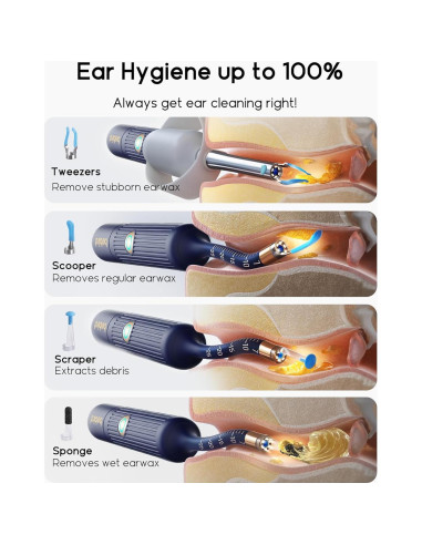 Kit de limpieza de oídos Earsight Plus con cámara HD