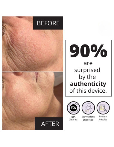 Dispositivo Facial MyoLift Mini 7E Wellness - Microcorriente 400mA