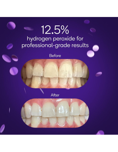 Kit Blanqueador Dental BURST | 3 Tratamientos | 12.5% Peróxido