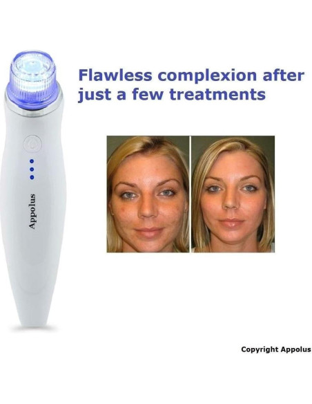 Máquina de Microdermoabrasión Appolus - Anti-Envejecimiento Máquina de Microdermoabrasión Appolus - Anti-Envejecimiento