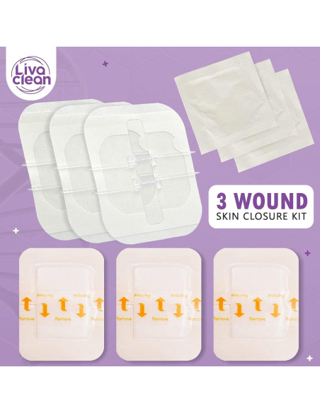 Tiras de Cierre de Heridas LivaClean 2.3x2.3 cm - Kit 3 Pzas Tiras de Cierre de Heridas LivaClean 2.3x2.3 cm - Kit 3 Pzas