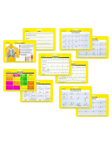 Juego de 5 Tarjetas EKG Silver Maple Leaf para Enfermeras