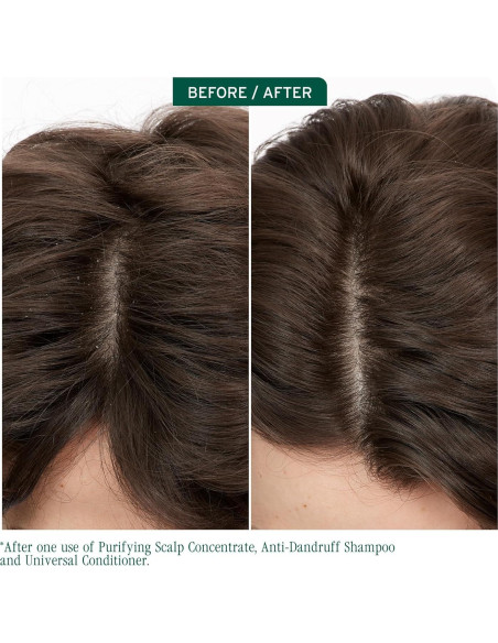 Champú Anticaspa Biolage Scalp Sync 50 ml - Vegano y Eficaz Champú Anticaspa Biolage Scalp Sync 50 ml - Vegano y Eficaz