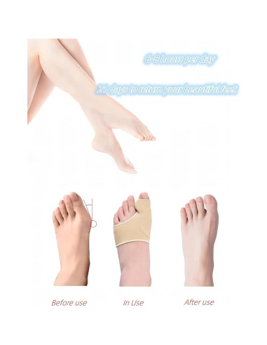 Corrector de Juanetes KAEZDD con Almohadillas de Gel - Talla S
