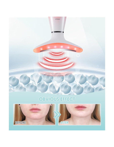 Masajeador Facial Rosa Aozemei 7 Colores con Calor Masajeador Facial Rosa Aozemei 7 Colores con Calor
