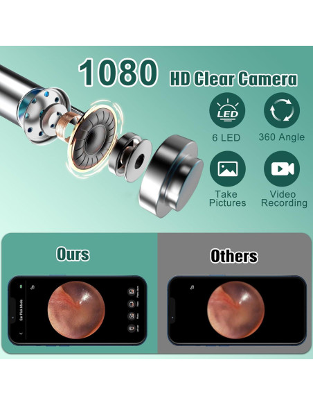 Otoscopio LMECHN con Cámara HD 1080P y 6 Luces LED Otoscopio LMECHN con Cámara HD 1080P y 6 Luces LED
