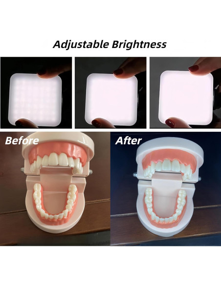 Luz Dental Portátil RXLIFE LED Recargable con Bolsa 0.63kg Luz Dental Portátil RXLIFE LED Recargable con Bolsa 0.63kg