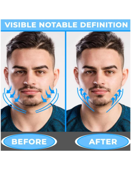 Ejercitador de Mandíbula ZOHA - Tonificación Facial Unisex Ejercitador de Mandíbula ZOHA - Tonificación Facial Unisex
