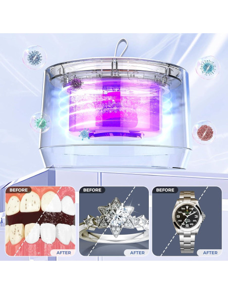 Limpiador ultrasónico portátil Smarbird 48kHz con UV - Negro