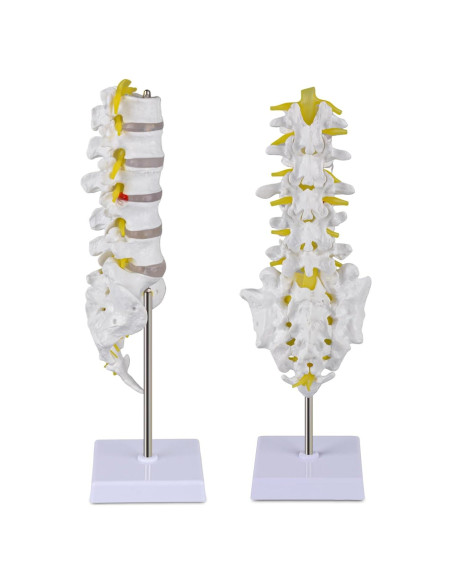 Modelo de Columna Lumbar Ultrassist con Discos Herniados 31.85cm Modelo de Columna Lumbar Ultrassist con Discos Herniados 31.85cm