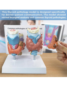 Modelo Anatómico de Tiroides Humana Evotech - 4 Partes 2