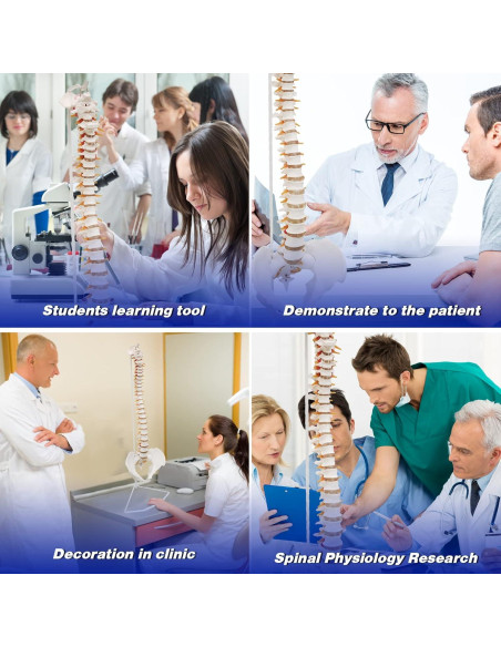 Modelo de Columna Vertebral Humana Ultrassist 86 cm con Soporte Modelo de Columna Vertebral Humana Ultrassist 86 cm con Soporte