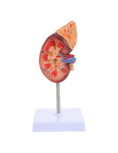 Modelo de Riñón Amosfun 1:1 para Anatomía y Biología