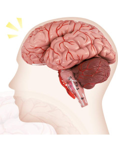 Modelo de Cerebro Humano Evotech 9 Piezas PVC a Tamaño Real 2