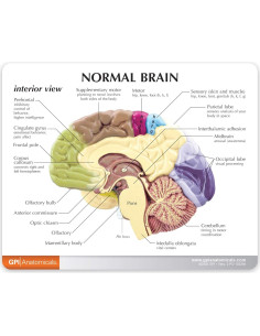 Modelo de Cerebro Medio GPI Anatomicals con Patologías y Base 2