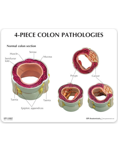 Modelo de Colon GPI Anatomicals 4 Piezas para Educación Médica Modelo de Colon GPI Anatomicals 4 Piezas para Educación Médica