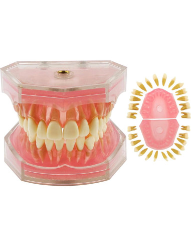 Modelo de Dientes de Demostración Dental Dentalmall 4004 Removibles
