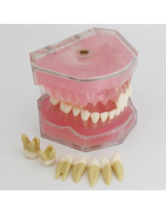 Modelo de Diente de Implante Dental Smile1000 con Dientes Removibles 2