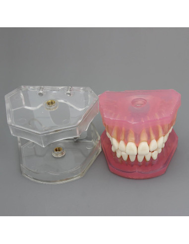 Modelo de Diente de Implante Dental Smile1000 con Dientes Removibles