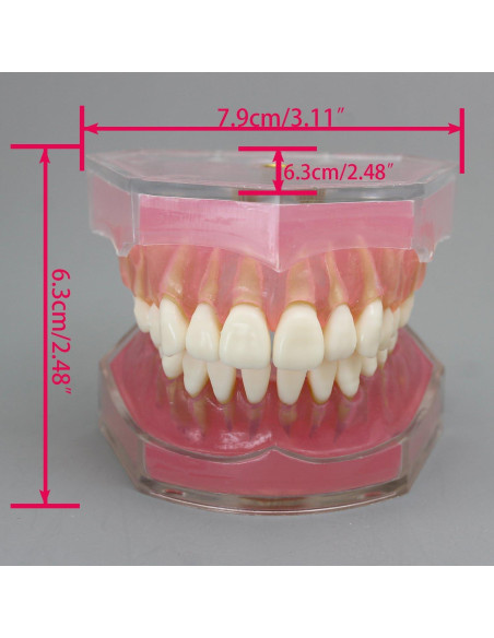Modelo de Diente de Implante Dental Smile1000 con Dientes Removibles Modelo de Diente de Implante Dental Smile1000 con Dientes Removibles