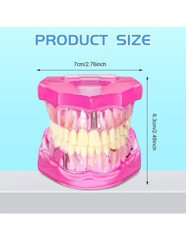 Modelo de Dientes Patológicos Outus Rosa 2 Piezas para Educación Dental