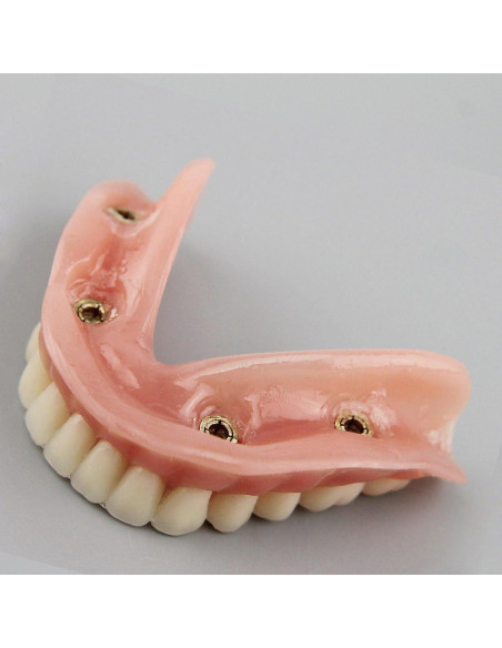 Modelo Dental Sobredentadura Inferior Smile1000 4 Implantes Modelo Dental Sobredentadura Inferior Smile1000 4 Implantes