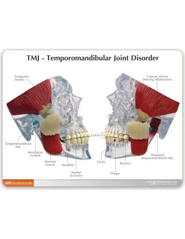 Modelo de Articulación Temporomandibular GPI Anatomicals 15cm