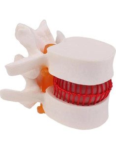 Modelo Lumbar de Columna 1.5x PVC Vocadok para Medicina 2