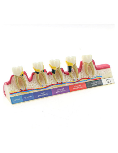 Modelo Dental Periodontal BLDYAKANG para Educación Oral