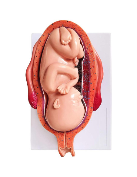 Modelo Anatómico del Feto Wellden Medical 8 Etapas Modelo Anatómico del Feto Wellden Medical 8 Etapas