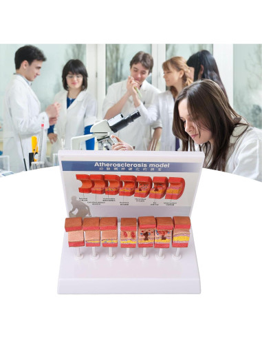 Modelo de Anatomía Arterial 7 Piezas ZJchao PVC Educativo