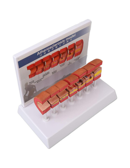 Modelo de Anatomía Arterial 7 Piezas ZJchao PVC Educativo