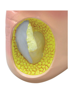 Modelo de Pie Izquierdo con Gota GPI Anatomicals 22.2x10.2cm 2