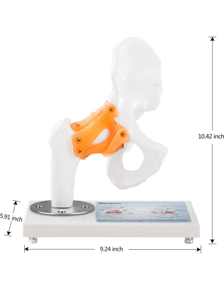 Modelo Anatómico de Articulación de Cadera Ultrassist 1:1 PVC Modelo Anatómico de Articulación de Cadera Ultrassist 1:1 PVC