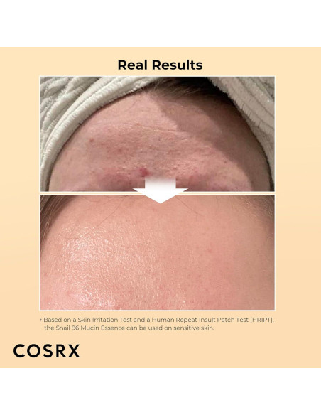 COSRX Crema de Caracol 92 y Esencia 96 - Hidratante Facial COSRX Crema de Caracol 92 y Esencia 96 - Hidratante Facial