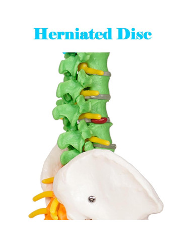 Modelo de Columna Vertebral Mini Breesky 39.37 cm Colorido