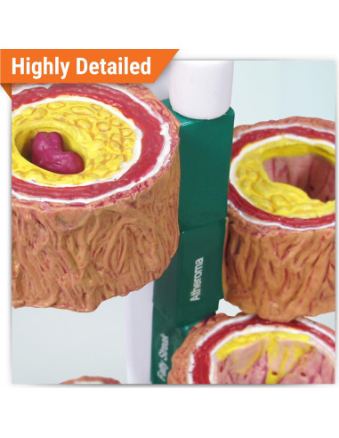 Modelo de Arteria GPI Anatomicals 4 Piezas para Educación Médica