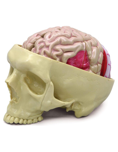 Modelo de Cerebro GPI Anatomicals con Patologías Educativas