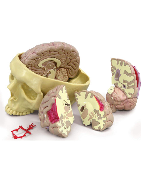 Modelo de Cerebro GPI Anatomicals con Patologías Educativas Modelo de Cerebro GPI Anatomicals con Patologías Educativas