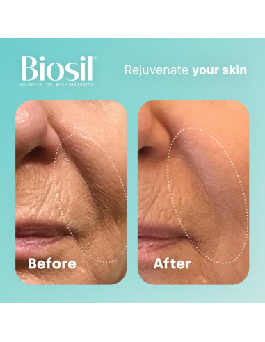 Biosil Generador de Colágeno - 120 Cápsulas - ch-OSA