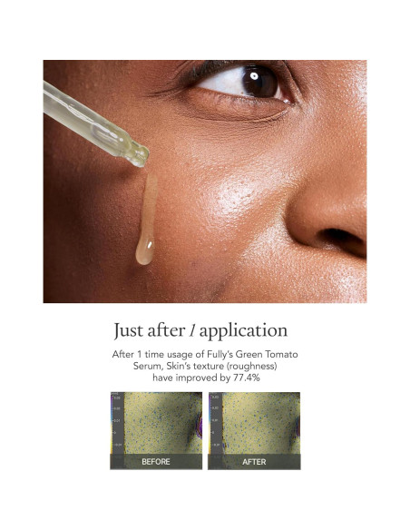 Kit de Cuidado Facial Fully con Extracto de Tomate Verde - Hidratación y Reducción de Poros Kit de Cuidado Facial Fully con Extracto de Tomate Verde - Hidratación y Reducción de Poros