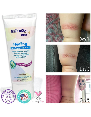 Crema Sanadora Multifuncional TriDerma Baby 56.7 g para Bebés