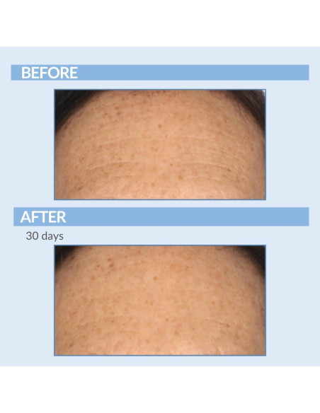 Crema de Retinol Serious Skincare 59 ml - Antienvejecimiento Crema de Retinol Serious Skincare 59 ml - Antienvejecimiento