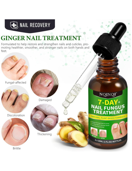 Tratamiento de Hongos en Uñas Fungi Nail 30ml - 2PCS Tratamiento de Hongos en Uñas Fungi Nail 30ml - 2PCS