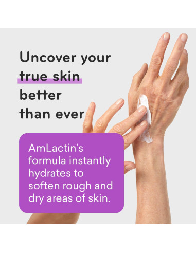 Crema Hidratante AmLactin Ultra Suavizante 140 g - 15% Ácido Láctico