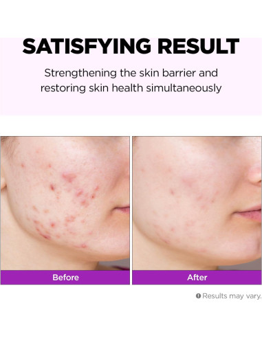 Emulsión Reparadora Hidratante Facial Farmskin Hyalusteen 120ml