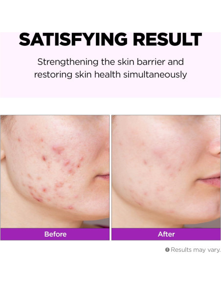 Emulsión Reparadora Hidratante Facial Farmskin Hyalusteen 120ml Emulsión Reparadora Hidratante Facial Farmskin Hyalusteen 120ml