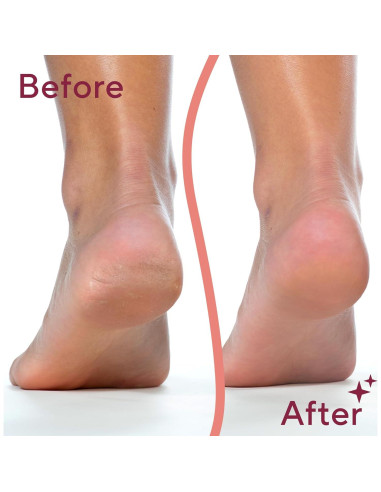 Herramienta Electrónica de Pedicura Flawless Pedi - Eliminador de Callos