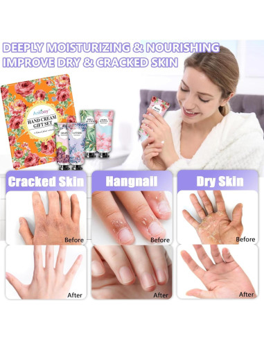 Set de 10 Cremas de Manos Naturales CMWGKBC - Hidratación Profunda